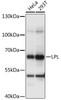 Western blot analysis of extracts of various cell lines, using LPL antibody (16-512) at 1:1000 dilution.<br/>Secondary antibody: HRP Goat Anti-Rabbit IgG (H+L) at 1:10000 dilution.<br/>Lysates/proteins: 25ug per lane.<br/>Blocking buffer: 3% nonfat dry milk in TBST.<br/>Detection: ECL Basic Kit.<br/>Exposure time: 1s.