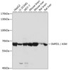 Western blot analysis of extracts of various cell lines, using SMPD1 / ASM antibody (16-515) at 1:1000 dilution.<br/>Secondary antibody: HRP Goat Anti-Rabbit IgG (H+L) at 1:10000 dilution.<br/>Lysates/proteins: 25ug per lane.<br/>Blocking buffer: 3% nonfat dry milk in TBST.<br/>Detection: ECL Basic Kit.<br/>Exposure time: 30s.