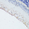 Immunohistochemistry of paraffin-embedded rat retina using OPN4 antibody (16-530) at dilution of 1:200 (40x lens) .