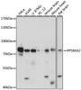 Western blot analysis of extracts of various cell lines, using RPS6KA2 antibody (16-539) at 1:1000 dilution.<br/>Secondary antibody: HRP Goat Anti-Rabbit IgG (H+L) at 1:10000 dilution.<br/>Lysates/proteins: 25ug per lane.<br/>Blocking buffer: 3% nonfat dry milk in TBST.<br/>Detection: ECL Basic Kit.<br/>Exposure time: 30s.