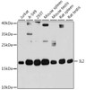 Western blot analysis of extracts of various cell lines, using IL2 antibody (16-547) at 1:1000 dilution.<br/>Secondary antibody: HRP Goat Anti-Rabbit IgG (H+L) at 1:10000 dilution.<br/>Lysates/proteins: 25ug per lane.<br/>Blocking buffer: 3% nonfat dry milk in TBST.<br/>Detection: ECL Basic Kit.<br/>Exposure time: 30s.
