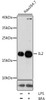 Western blot analysis of extracts of Raw264.7 cells, using IL2 antibody (16-547) at 1:1000 dilution. Raw264.7 cells were treated by LPS for 6 hours and Brefeldin A for 3 hours of stimulation.<br/>Secondary antibody: HRP Goat Anti-Rabbit IgG (H+L) at 1:10000 dilution.<br/>Lysates/proteins: 25ug per lane.<br/>Blocking buffer: 3% nonfat dry milk in TBST.<br/>Detection: ECL Basic Kit.<br/>Exposure time: 30s.