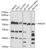 Western blot analysis of extracts of various cell lines, using HMGCR antibody (16-554) at 1:1000 dilution.<br/>Secondary antibody: HRP Goat Anti-Rabbit IgG (H+L) at 1:10000 dilution.<br/>Lysates/proteins: 25ug per lane.<br/>Blocking buffer: 3% nonfat dry milk in TBST.<br/>Detection: ECL Basic Kit.<br/>Exposure time: 10s.