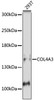 Western blot analysis of extracts of 293T cells, using COL4A3 antibody (16-569) at 1:1000 dilution.<br/>Secondary antibody: HRP Goat Anti-Rabbit IgG (H+L) at 1:10000 dilution.<br/>Lysates/proteins: 25ug per lane.<br/>Blocking buffer: 3% nonfat dry milk in TBST.<br/>Detection: ECL Basic Kit.<br/>Exposure time: 30s.