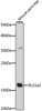 Western blot analysis of extracts of mouse pancreas, using Slc31a2 antibody (16-570) at 1:500 dilution.<br/>Secondary antibody: HRP Goat Anti-Rabbit IgG (H+L) at 1:10000 dilution.<br/>Lysates/proteins: 25ug per lane.<br/>Blocking buffer: 3% nonfat dry milk in TBST.<br/>Detection: ECL Basic Kit.<br/>Exposure time: 90s.