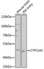 Western blot analysis of extracts of various cell lines, using CYP11A1 antibody (16-571) at 1:1000 dilution.<br/>Secondary antibody: HRP Goat Anti-Rabbit IgG (H+L) at 1:10000 dilution.<br/>Lysates/proteins: 25ug per lane.<br/>Blocking buffer: 3% nonfat dry milk in TBST.<br/>Detection: ECL Basic Kit.<br/>Exposure time: 10s.