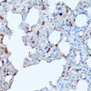 Immunohistochemistry of paraffin-embedded rat lung using CXCR1 antibody (16-582) at dilution of 1:100 (40x lens) .