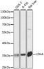 Western blot analysis of extracts of various cell lines, using LDHA antibody (16-586) at 1:1000 dilution.<br/>Secondary antibody: HRP Goat Anti-Rabbit IgG (H+L) at 1:10000 dilution.<br/>Lysates/proteins: 25ug per lane.<br/>Blocking buffer: 3% nonfat dry milk in TBST.<br/>Detection: ECL Basic Kit.<br/>Exposure time: 1s.