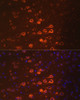 Immunofluorescence analysis of mouse brain using NEFM antibody (16-591) at dilution of 1:100. Blue: DAPI for nuclear staining.