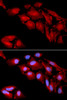 Immunofluorescence analysis of U2OS cells using CTNND1 antibody (16-592) . Blue: DAPI for nuclear staining.