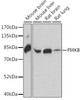 Western blot analysis of extracts of various cell lines, using PI4KB antibody (16-595) at 1:1000 dilution.<br/>Secondary antibody: HRP Goat Anti-Rabbit IgG (H+L) at 1:10000 dilution.<br/>Lysates/proteins: 25ug per lane.<br/>Blocking buffer: 3% nonfat dry milk in TBST.<br/>Detection: ECL Basic Kit.<br/>Exposure time: 90s.