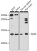 Western blot analysis of extracts of various cell lines, using SAA4 antibody (16-598) at 1:1000 dilution.<br/>Secondary antibody: HRP Goat Anti-Rabbit IgG (H+L) at 1:10000 dilution.<br/>Lysates/proteins: 25ug per lane.<br/>Blocking buffer: 3% nonfat dry milk in TBST.<br/>Detection: ECL Basic Kit.<br/>Exposure time: 90s.