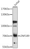 Western blot analysis of extracts of Jurkat cells, using ZNF189 antibody (16-609) at 1:1000 dilution.<br/>Secondary antibody: HRP Goat Anti-Rabbit IgG (H+L) at 1:10000 dilution.<br/>Lysates/proteins: 25ug per lane.<br/>Blocking buffer: 3% nonfat dry milk in TBST.<br/>Detection: ECL Basic Kit.<br/>Exposure time: 10s.