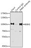 Immunoprecipitation analysis of 200ug extracts of K-562 cells, using 3 ug IKBKE antibody (16-620) . Western blot was performed from the immunoprecipitate using IKBKE antibody (16-620) at a dilition of 1:1000.