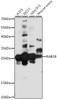 Western blot analysis of extracts of various cell lines, using RAB38 antibody (16-634) at 1:1000 dilution.<br/>Secondary antibody: HRP Goat Anti-Rabbit IgG (H+L) at 1:10000 dilution.<br/>Lysates/proteins: 25ug per lane.<br/>Blocking buffer: 3% nonfat dry milk in TBST.<br/>Detection: ECL Basic Kit.<br/>Exposure time: 90s.