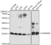 Western blot analysis of extracts of various cell lines, using COMMD5 antibody (16-638) at 1:1000 dilution.<br/>Secondary antibody: HRP Goat Anti-Rabbit IgG (H+L) at 1:10000 dilution.<br/>Lysates/proteins: 25ug per lane.<br/>Blocking buffer: 3% nonfat dry milk in TBST.<br/>Detection: ECL Basic Kit.<br/>Exposure time: 1s.