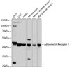 Western blot analysis of extracts of various cell lines, using Adiponectin Receptor 1 antibody (16-643) at 1:1000 dilution.<br/>Secondary antibody: HRP Goat Anti-Rabbit IgG (H+L) at 1:10000 dilution.<br/>Lysates/proteins: 25ug per lane.<br/>Blocking buffer: 3% nonfat dry milk in TBST.<br/>Detection: ECL Basic Kit.<br/>Exposure time: 5s.