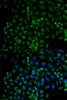 Immunofluorescence analysis of HeLa cells using Beta-TRCP antibody (16-657) . Blue: DAPI for nuclear staining.