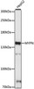 Western blot analysis of extracts of HepG2 cells, using MYPN antibody (16-666) at 1:1000 dilution.<br/>Secondary antibody: HRP Goat Anti-Rabbit IgG (H+L) at 1:10000 dilution.<br/>Lysates/proteins: 25ug per lane.<br/>Blocking buffer: 3% nonfat dry milk in TBST.<br/>Detection: ECL Basic Kit.<br/>Exposure time: 90s.