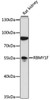 Western blot analysis of extracts of rat kidney, using RBMY1F antibody (16-675) at 1:1000 dilution.<br/>Secondary antibody: HRP Goat Anti-Rabbit IgG (H+L) at 1:10000 dilution.<br/>Lysates/proteins: 25ug per lane.<br/>Blocking buffer: 3% nonfat dry milk in TBST.<br/>Detection: ECL Basic Kit.<br/>Exposure time: 1s.