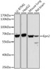 Western blot analysis of extracts of various cell lines, using Epn2 antibody (16-684) at 1:1000 dilution.<br/>Secondary antibody: HRP Goat Anti-Rabbit IgG (H+L) at 1:10000 dilution.<br/>Lysates/proteins: 25ug per lane.<br/>Blocking buffer: 3% nonfat dry milk in TBST.<br/>Detection: ECL Basic Kit.<br/>Exposure time: 90s.