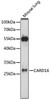 Western blot analysis of extracts of mouse lung, using CARD16 antibody (16-685) at 1:1000 dilution.<br/>Secondary antibody: HRP Goat Anti-Rabbit IgG (H+L) at 1:10000 dilution.<br/>Lysates/proteins: 25ug per lane.<br/>Blocking buffer: 3% nonfat dry milk in TBST.<br/>Detection: ECL Basic Kit.<br/>Exposure time: 90s.