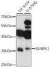 Western blot analysis of extracts of various cell lines, using IGFBPL1 antibody (16-690) at 1:1000 dilution.<br/>Secondary antibody: HRP Goat Anti-Rabbit IgG (H+L) at 1:10000 dilution.<br/>Lysates/proteins: 25ug per lane.<br/>Blocking buffer: 3% nonfat dry milk in TBST.<br/>Detection: ECL Basic Kit.<br/>Exposure time: 300s.
