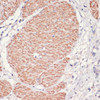 Immunohistochemistry of paraffin-embedded human smooth muscle using AMPK alpha 1 antibody (16-698) at dilution of 1:200 (40x lens) .