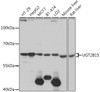 Western blot analysis of extracts of various cell lines, using UGT2B15 antibody (16-699) at 1:1000 dilution.<br/>Secondary antibody: HRP Goat Anti-Rabbit IgG (H+L) at 1:10000 dilution.<br/>Lysates/proteins: 25ug per lane.<br/>Blocking buffer: 3% nonfat dry milk in TBST.<br/>Detection: ECL Basic Kit.<br/>Exposure time: 5s.