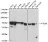 Western blot analysis of extracts of various cell lines, using P70 S6K antibody (16-700) at 1:1000 dilution.<br/>Secondary antibody: HRP Goat Anti-Rabbit IgG (H+L) at 1:10000 dilution.<br/>Lysates/proteins: 25ug per lane.<br/>Blocking buffer: 3% nonfat dry milk in TBST.<br/>Detection: ECL Basic Kit.<br/>Exposure time: 1s.