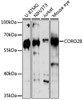 Western blot analysis of extracts of various cell lines, using CORO2B antibody (16-705) at 1:3000 dilution.<br/>Secondary antibody: HRP Goat Anti-Rabbit IgG (H+L) at 1:10000 dilution.<br/>Lysates/proteins: 25ug per lane.<br/>Blocking buffer: 3% nonfat dry milk in TBST.<br/>Detection: ECL Basic Kit.<br/>Exposure time: 60s.