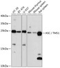 Western blot analysis of extracts of various cell lines, using ASC / TMS1 antibody (16-706) at 1:1000 dilution.<br/>Secondary antibody: HRP Goat Anti-Rabbit IgG (H+L) at 1:10000 dilution.<br/>Lysates/proteins: 25ug per lane.<br/>Blocking buffer: 3% nonfat dry milk in TBST.<br/>Detection: ECL Basic Kit.<br/>Exposure time: 30s.