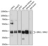 Western blot analysis of extracts of various cell lines, using ERK1 / ERK2 antibody (16-712) at 1:1000 dilution.<br/>Secondary antibody: HRP Goat Anti-Rabbit IgG (H+L) at 1:10000 dilution.<br/>Lysates/proteins: 25ug per lane.<br/>Blocking buffer: 3% nonfat dry milk in TBST.<br/>Detection: ECL Basic Kit.<br/>Exposure time: 10s.