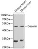 Western blot analysis of extracts of various cell lines, using Decorin antibody (16-716) at 1:1000 dilution.<br/>Secondary antibody: HRP Goat Anti-Rabbit IgG (H+L) at 1:10000 dilution.<br/>Lysates/proteins: 25ug per lane.<br/>Blocking buffer: 3% nonfat dry milk in TBST.