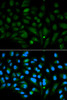 Immunofluorescence analysis of MCF-7 cells using Decorin antibody (16-716) . Blue: DAPI for nuclear staining.