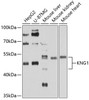 Western blot analysis of extracts of various cell lines, using KNG1 antibody (16-720) at 1:1000 dilution.<br/>Secondary antibody: HRP Goat Anti-Rabbit IgG (H+L) at 1:10000 dilution.<br/>Lysates/proteins: 25ug per lane.<br/>Blocking buffer: 3% nonfat dry milk in TBST.<br/>Detection: ECL Basic Kit.<br/>Exposure time: 30s.