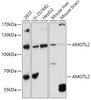 Western blot analysis of extracts of various cell lines, using AMOTL2 antibody (16-729) at 1:1000 dilution.<br/>Secondary antibody: HRP Goat Anti-Rabbit IgG (H+L) at 1:10000 dilution.<br/>Lysates/proteins: 25ug per lane.<br/>Blocking buffer: 3% nonfat dry milk in TBST.<br/>Detection: ECL Basic Kit.<br/>Exposure time: 30s.