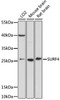 Western blot analysis of extracts of various cell lines, using SURF4 antibody (16-739) at 1:1000 dilution.<br/>Secondary antibody: HRP Goat Anti-Rabbit IgG (H+L) at 1:10000 dilution.<br/>Lysates/proteins: 25ug per lane.<br/>Blocking buffer: 3% nonfat dry milk in TBST.<br/>Detection: ECL Basic Kit.<br/>Exposure time: 10s.