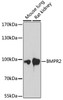 Western blot analysis of extracts of various cell lines, using BMPR2 antibody (16-748) at 1:1000 dilution.<br/>Secondary antibody: HRP Goat Anti-Rabbit IgG (H+L) at 1:10000 dilution.<br/>Lysates/proteins: 25ug per lane.<br/>Blocking buffer: 3% nonfat dry milk in TBST.<br/>Detection: ECL Basic Kit.<br/>Exposure time: 90s.