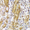 Immunohistochemistry of paraffin-embedded human stomach using CAST antibody (16-749) at dilution of 1:100 (40x lens) .