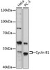 Western blot analysis of extracts of various cell lines, using Cyclin B1 antibody (16-755) at 1:1000 dilution.<br/>Secondary antibody: HRP Goat Anti-Rabbit IgG (H+L) at 1:10000 dilution.<br/>Lysates/proteins: 25ug per lane.<br/>Blocking buffer: 3% nonfat dry milk in TBST.<br/>Detection: ECL Basic Kit.<br/>Exposure time: 3min.