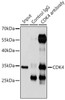 Immunoprecipitation analysis of 200ug extracts of 293T cells using 3ug CDK4 antibody (16-759) . Western blot was performed from the immunoprecipitate using CDK4 antibody (16-759) at a dilition of 1:1000.