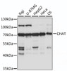 Western blot analysis of extracts of various cell line, using CHAT antibody (16-762) at 1:1000 dilution.<br/>Secondary antibody: HRP Goat Anti-Rabbit IgG (H+L) at 1:10000 dilution.<br/>Lysates/proteins: 25ug per lane.<br/>Blocking buffer: 3% nonfat dry milk in TBST.<br/>Detection: ECL Basic Kit.<br/>Exposure time: 5s.