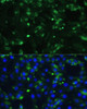 Immunofluorescence analysis of C6 cells using ENO1 antibody (16-771) at dilution of 1:100. Blue: DAPI for nuclear staining.