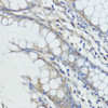 Immunohistochemistry of paraffin-embedded human colon using FXN / Frataxin antibody (16-775) at dilution of 1:100 (40x lens) .