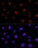 Immunofluorescence analysis of L-929 cells using GLI2 antibody (16-777) at dilution of 1:100. Blue: DAPI for nuclear staining.