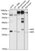 Western blot analysis of extracts of various cell lines, using MPZ antibody (16-779) at 1:1000 dilution.<br/>Secondary antibody: HRP Goat Anti-Rabbit IgG (H+L) at 1:10000 dilution.<br/>Lysates/proteins: 25ug per lane.<br/>Blocking buffer: 3% nonfat dry milk in TBST.<br/>Detection: ECL Enhanced Kit.<br/>Exposure time: 60s.