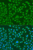 Immunofluorescence analysis of U2OS cells using EWSR1 antibody (16-791) at dilution of 1:100. Blue: DAPI for nuclear staining.