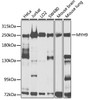 Western blot analysis of extracts of various cell lines, using MYH9 antibody (16-801) at 1:1000 dilution.<br/>Secondary antibody: HRP Goat Anti-Rabbit IgG (H+L) at 1:10000 dilution.<br/>Lysates/proteins: 25ug per lane.<br/>Blocking buffer: 3% nonfat dry milk in TBST.<br/>Detection: ECL Basic Kit.<br/>Exposure time: 5s.