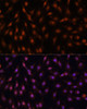 Immunofluorescence analysis of C6 cells using P70 S6K antibody (16-817) at dilution of 1:100. Blue: DAPI for nuclear staining.